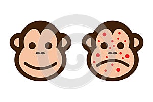 Cartoon monkey virus or monkeypox. Infectious disease.