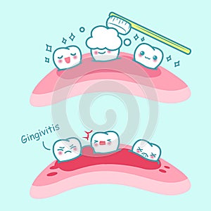 Cartoon tooth brush and gingivitis photo