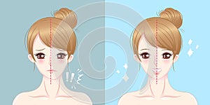 Cartoon woman asymmetry chin