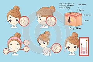 Cartoon woman face dry skin