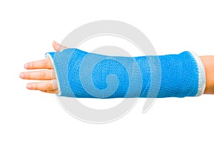 Cast of Childâ€™s Broken Arm Isolated on White Background