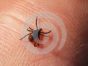 A castor bean tick, Ixodes ricinus, on the human skin