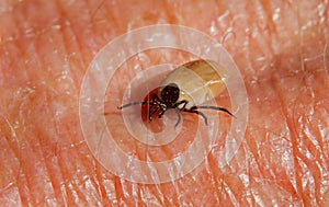 Castor bean tick on skin