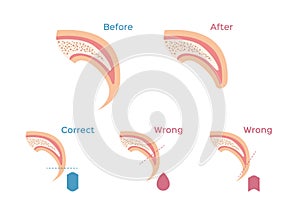 Cat, dog nail trimming / fingernail vector / nail