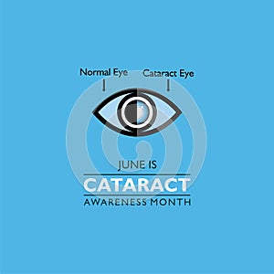 Cataract Awareness Month observed in June, It is a dense, cloudy area that forms in the lens of the eye