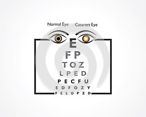 Cataract Awareness Month observed in June, It is a dense, cloudy area that forms in the lens of the eye