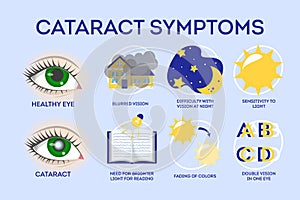 Cataract disease symptoms inographic. Eye illness, blindness