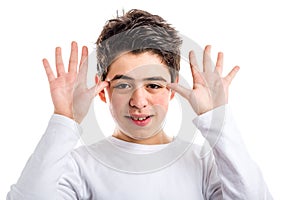 Caucasian boy with acne-prone skin grimacing with hands next to