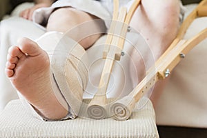 Caucasian male`s injured leg on footstool with crutches beside the stool.