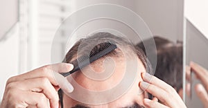 Caucasian man combing hair. Hair loss