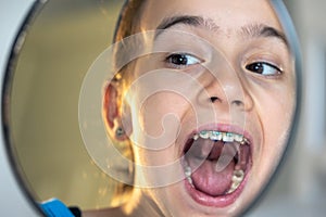 Caucasian preteen girl with braces on her teeth looking at the mirror.