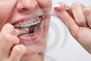 Caucasian woman cleaning her teeth with braces using dental floss. Cropped portrait.