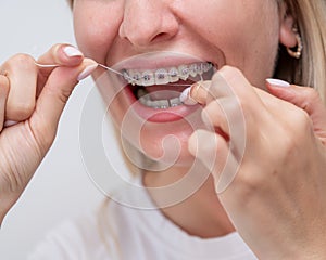 Caucasian woman cleaning her teeth with braces using dental floss. Cropped portrait.