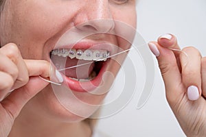 Caucasian woman cleaning her teeth with braces using dental floss. Cropped portrait.