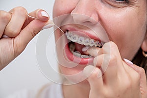 Caucasian woman cleaning her teeth with braces using dental floss. Cropped portrait.