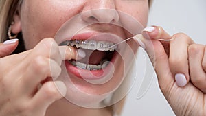 Caucasian woman cleaning her teeth with braces using dental floss. Cropped portrait.