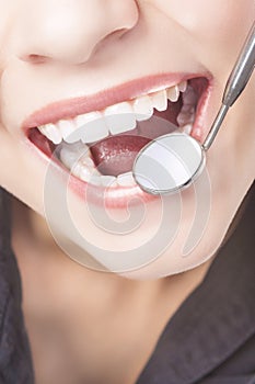 Caucasian Woman White Teeth with Dentist Mouth Mirror