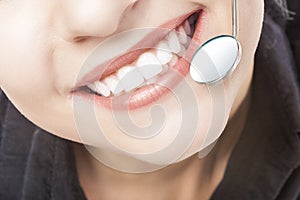 Caucasian Woman White Teeth with Dentist Mouth Mirror.