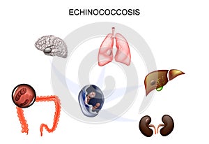 The causative agent Echinococcus photo