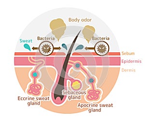 Cause of body odor vector illustration / circle type / english