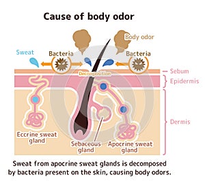 Cause of body odor vector illustration / english