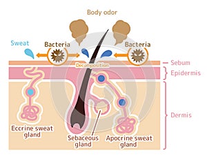 Cause of body odor vector illustration / english