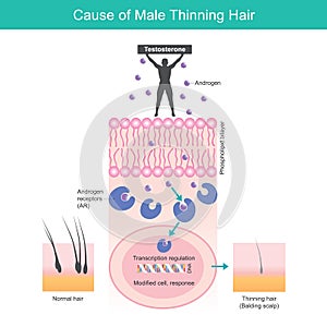 Cause of Male Thinning Hair. Illustration photo