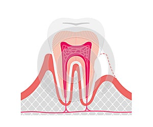 Cause and mechanism of Sensitive teeth vector illustration / no text