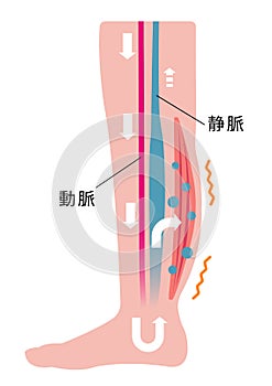 Cause of swelling, edema of the legs. / Japanese