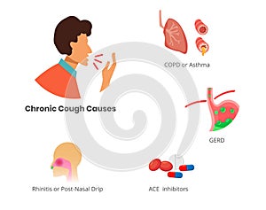 Causes of the chronic cough - asthma, allergies, and GERD photo