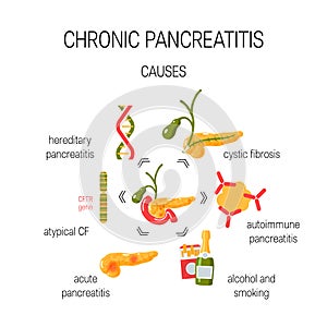 Causes of chronic pancreatitis concept. Vector illustration