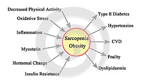 Causes and Consequences of Sarcopenia Obesity photo