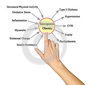 Causes and Consequences of Sarcopenia Obesity