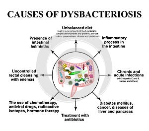 The causes of dysbiosis in the intestines. Colon. Bacteria pathogenic flora. Infographics. Vector