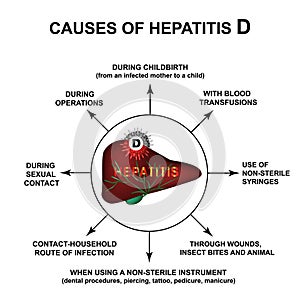 Causes of Hepatitis D. World Hepatitis Day. Infographics. Vector illustration on isolated background.