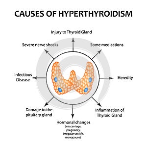 The causes of hyperthyroidism of the thyroid gland. Infographics. Vector illustration on background.
