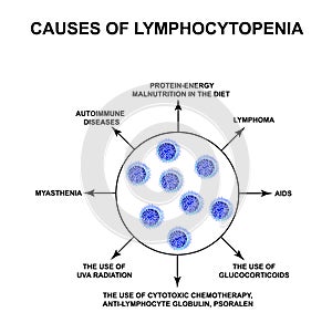 Causes of lymphocytopenia. Decreased lymphocytes in the blood. Infographics. Vector illustration on isolated background.