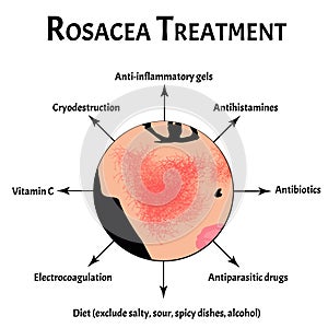 Causes of rosacea. Rosacea Awareness Month. Infographics. Vector illustration on isolated background.