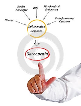 Causes of Sarcopenia photo