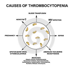 Causes of thrombocytopenia. Reducing platelets in the blood. Infographics. Vector illustration on isolated background. photo