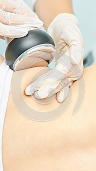 Cavitation rf body treatment. Female ultra sound lipo machine. Spa contouring. Doctor hands