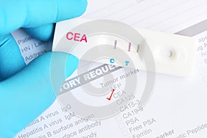 CEA or carcinoembryonic antigen positive by using rapid test photo