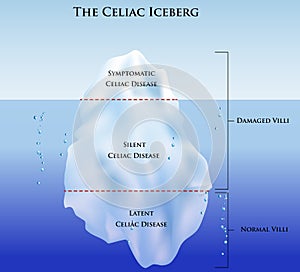 Celiac iceberg photo
