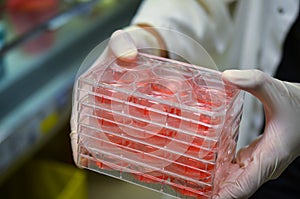 Cell cultures held by laboratory technician photo
