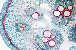 Cell microscopic- Cucurbits Stem photo