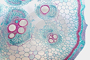Cell microscopic- Cucurbits Stem