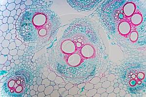 Cell microscopic- Cucurbits Stem photo