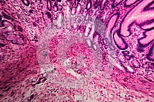 Cell microscopic- pyloric division stomach