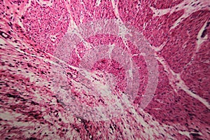 Cell microscopic- pyloric division stomach