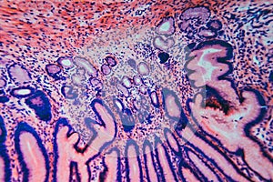 Cell microscopic- pyloric division stomach